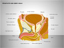 Prostate and Seminal Vesicles Diagram slide 1