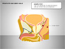 Prostate and Seminal Vesicles Diagram slide 15