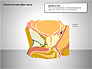 Prostate and Seminal Vesicles Diagram slide 16