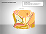 Prostate and Seminal Vesicles Diagram slide 2