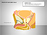 Prostate and Seminal Vesicles Diagram slide 7