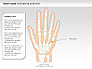 Right Hand Diagram slide 16