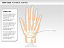 Right Hand Diagram slide 17