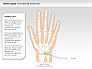 Right Hand Diagram slide 20