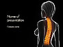 Female Spine Anatomy slide 1