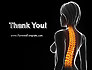 Female Spine Anatomy slide 20