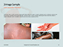 Skin Allergy on the Human Body Presentation slide 12