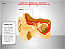 Human Ear Diagram slide 2