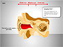 Human Ear Diagram slide 6