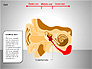 Human Ear Diagram slide 7