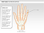 Right Hand Diagram slide 13