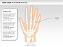 Right Hand Diagram slide 14