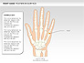 Right Hand Diagram slide 15
