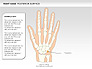 Right Hand Diagram slide 19