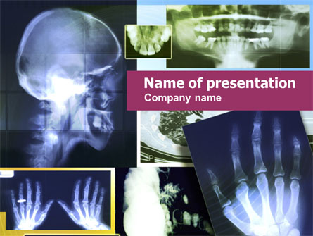 X-ray Images Presentation Template, Master Slide