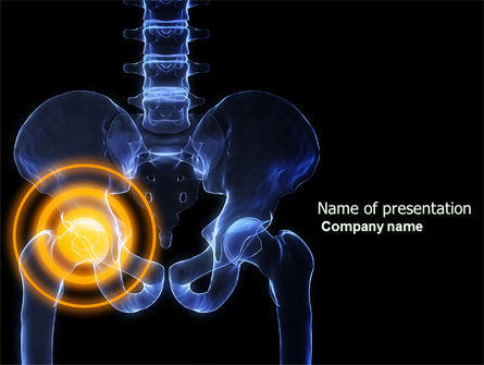 Joint Ache Presentation Template, Master Slide