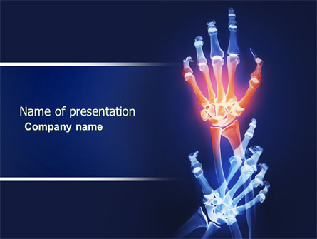 Arthritis Presentation Template, Master Slide