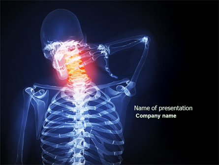 Neck Pain Presentation Template, Master Slide