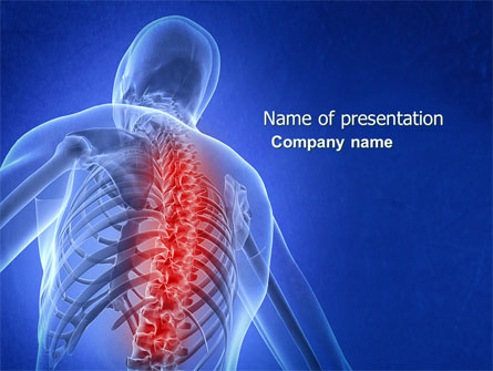 Osteoporosis Presentation Template, Master Slide