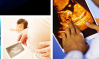 Ultrasound Collage Presentation Template