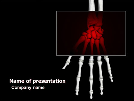 Skeleton Hand Presentation Template, Master Slide