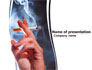 Quitting Smoking slide 1
