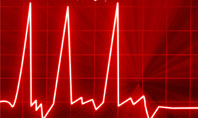 Heart Rhythm Presentation Template