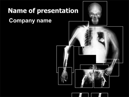 Radiograph Presentation Template, Master Slide