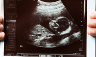 Ultrasound Portrait Of Baby Presentation Template