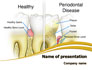 Periodontal Tooth slide 1