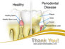 Periodontal Tooth slide 20
