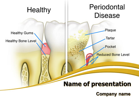 Periodontal Tooth Presentation Template, Master Slide
