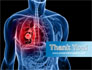 Lung Cancer slide 20