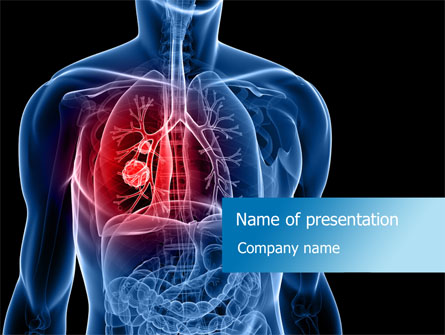 Lung Cancer Presentation Template, Master Slide