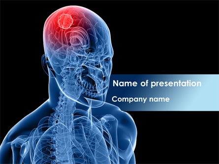 Brain Inflammation Presentation Template, Master Slide