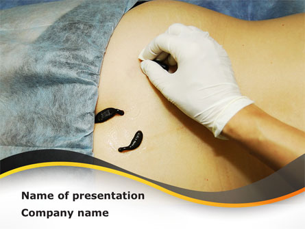 Leeches Therapy Presentation Template, Master Slide