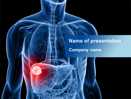 Liver Disease Presentation Template, Master Slide