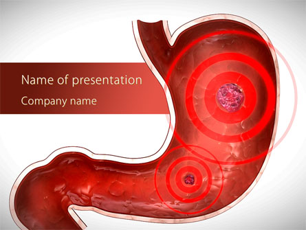 Stomach Ache Presentation Template, Master Slide