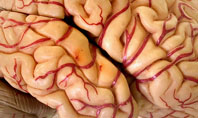 Human Brain As Anatomical Preparation Presentation Template