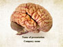 Human Brain As Anatomical Preparation slide 1