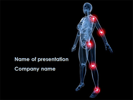 Arthronosos Presentation Template, Master Slide