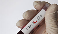 Testing Yourself For HIV Presentation Template