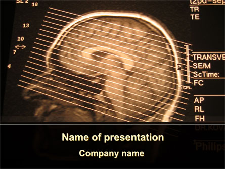 Brain Tomography Slice Presentation Template, Master Slide