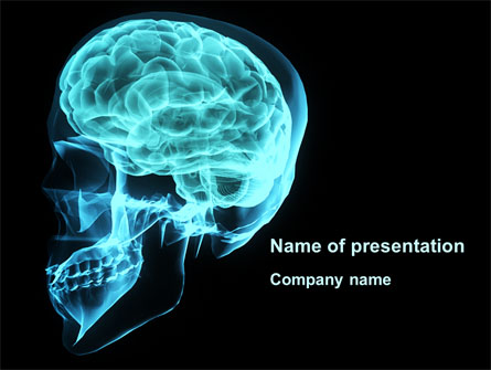 MRT Of Cranial Cavity Presentation Template, Master Slide