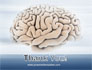 Human Brain Preparation slide 20