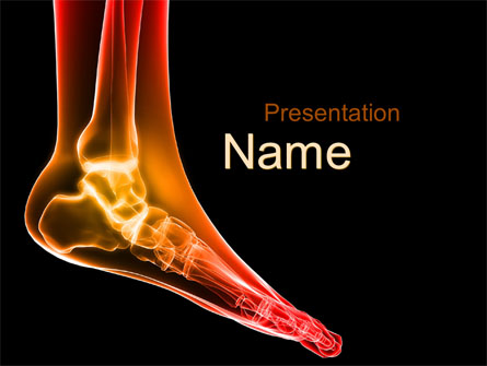 Ankle Radiography Presentation Template, Master Slide