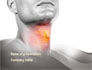 Diseases Of The Throat slide 1