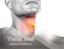 Diseases Of The Throat slide 20