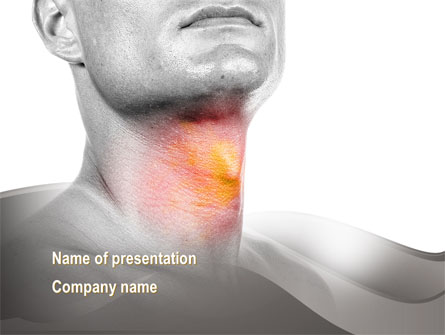 Diseases Of The Throat Presentation Template, Master Slide