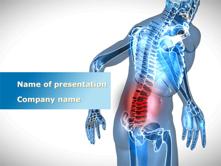 Lumbar Spine Presentation Template, Master Slide